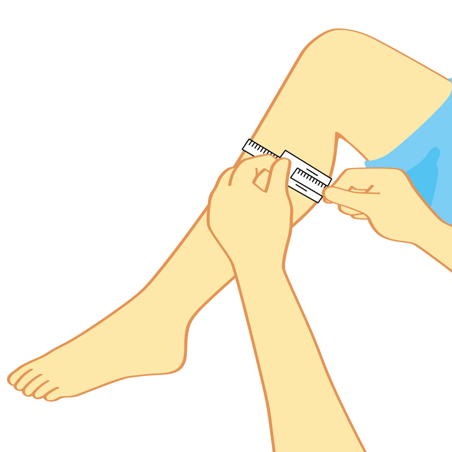 医療用イラスト | Medical illustration